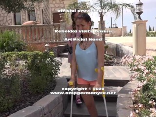 two amputee ladies