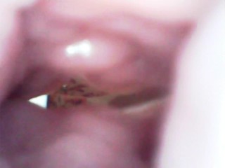 endoscope, masturbation from the interior